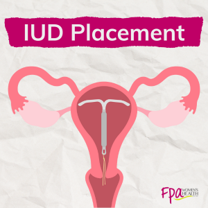 IUD blog image smaller.png